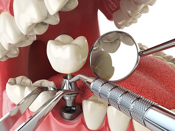 Best Emergency Cosmetic Dentistry in Shorewood Tower Hills Harbert, MI