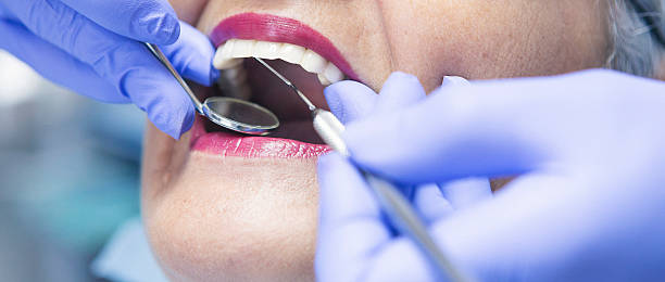Best Emergency Dental Care for Abscessed Tooth in Shorewood Tower Hills Harbert, MI